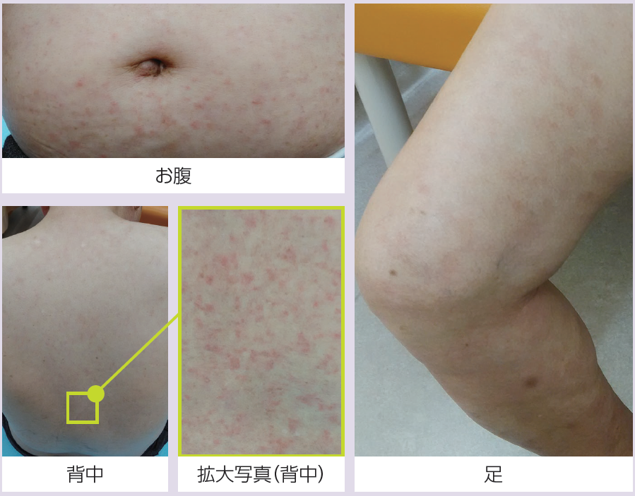 ヌベカのコスト